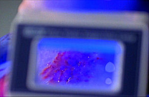 A mark is seen on Mike's neck underthe ultraviolet light.