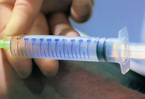 Angie takes a blood sample, but the syringe looks empty